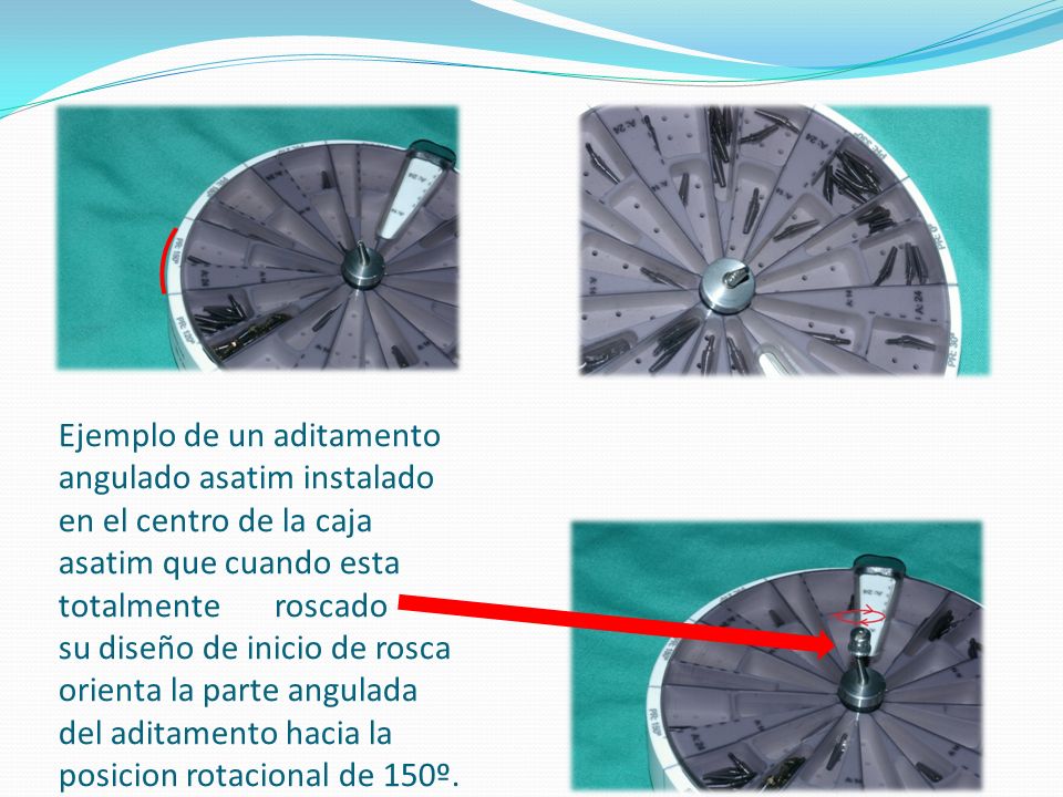 Ejemplo de un aditamento angulado asatim instalado en el centro de la caja asatim que cuando esta totalmente roscado su diseño de inicio de rosca orienta la parte angulada del aditamento hacia la posicion rotacional de 150º.