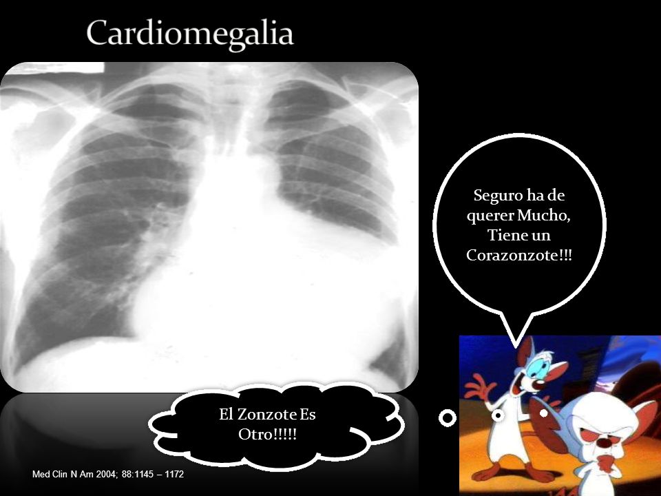 Seguro ha de querer Mucho, Tiene un Corazonzote!!!