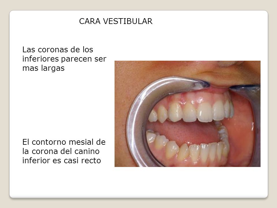CARA VESTIBULAR Las coronas de los inferiores parecen ser mas largas.