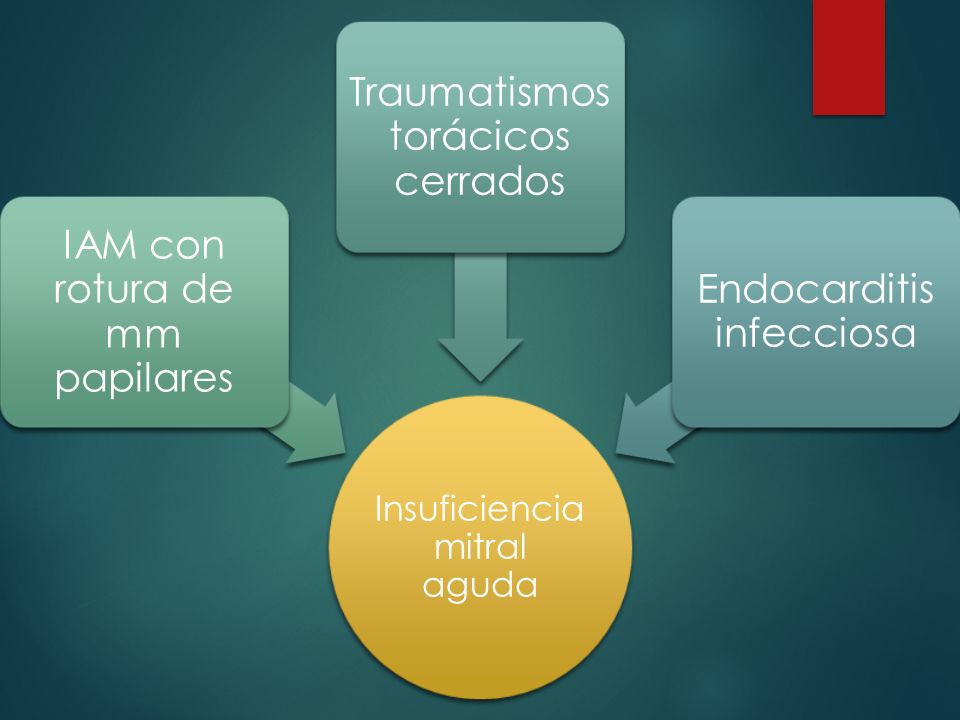 IAM con rotura de mm papilares Traumatismos torácicos cerrados