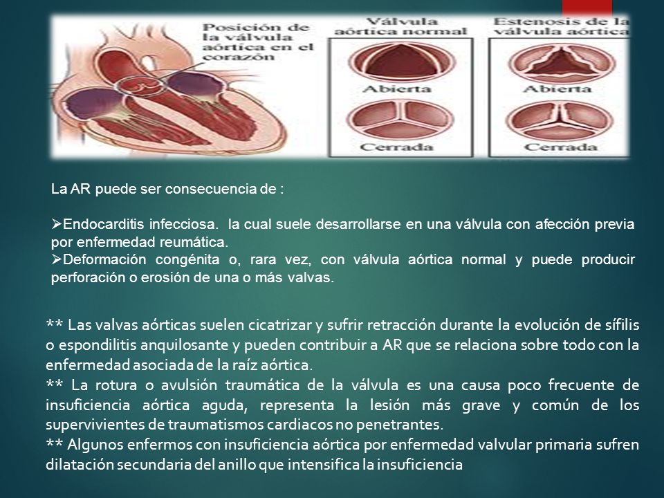 La AR puede ser consecuencia de :