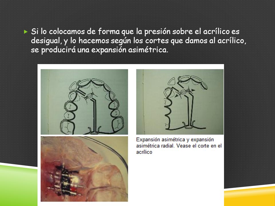 Si lo colocamos de forma que la presión sobre el acrílico es desigual, y lo hacemos según los cortes que damos al acrílico, se producirá una expansión asimétrica.