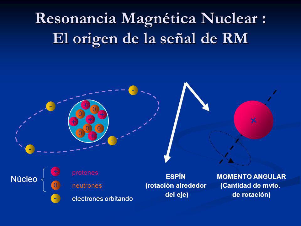 Resonancia Magnética Nuclear : El origen de la señal de RM