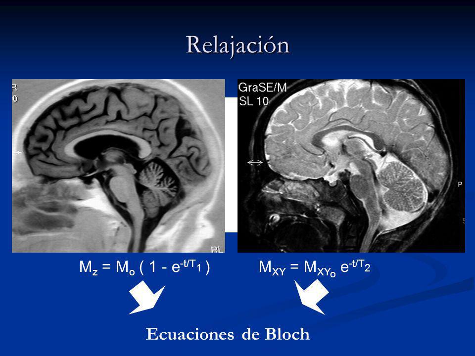 Relajación Ecuaciones de Bloch Mz = Mo ( 1 - e-t/T1 )