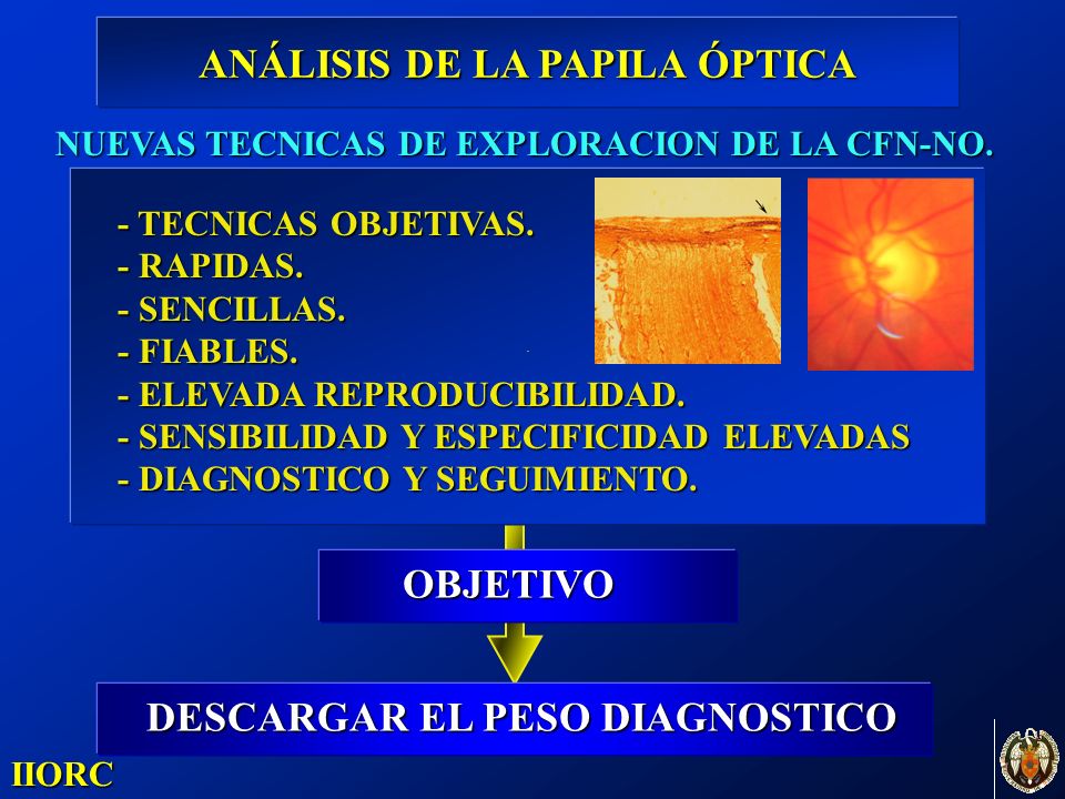 ANÁLISIS DE LA PAPILA ÓPTICA OBJETIVO DESCARGAR EL PESO DIAGNOSTICO