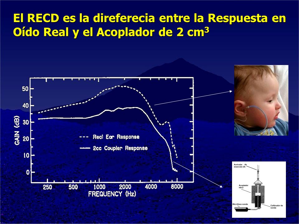 El RECD es la direferecia entre la Respuesta en Oído Real y el Acoplador de 2 cm3