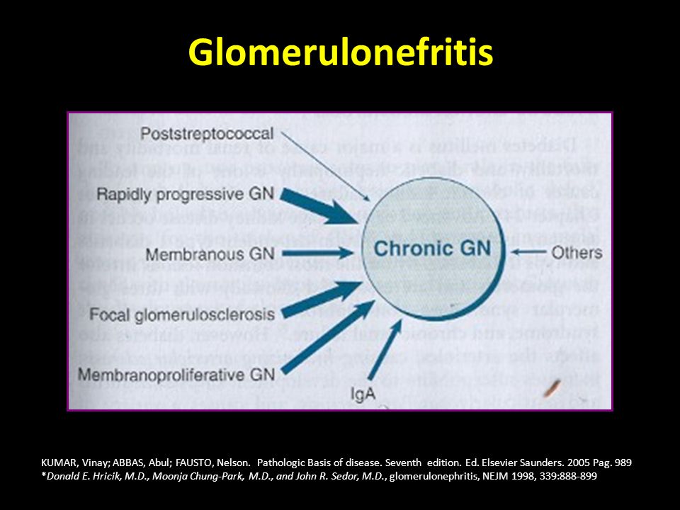 Glomerulonefritis KUMAR, Vinay; ABBAS, Abul; FAUSTO, Nelson. Pathologic Basis of disease. Seventh edition. Ed. Elsevier Saunders Pag