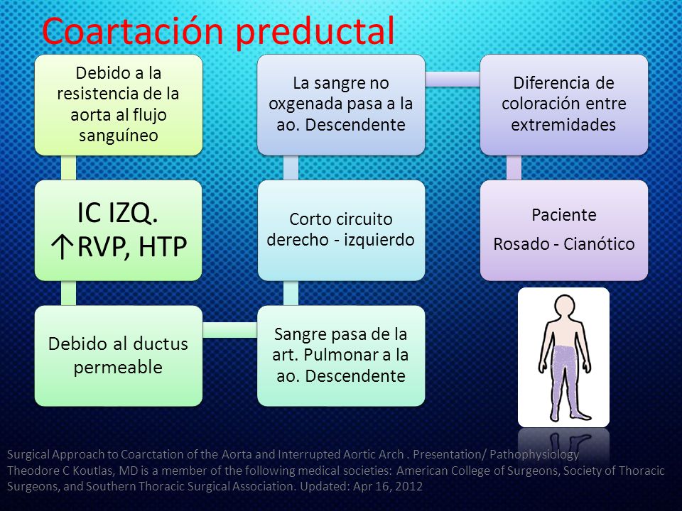 Coartación preductal IC IZQ. ↑RVP, HTP Debido al ductus permeable