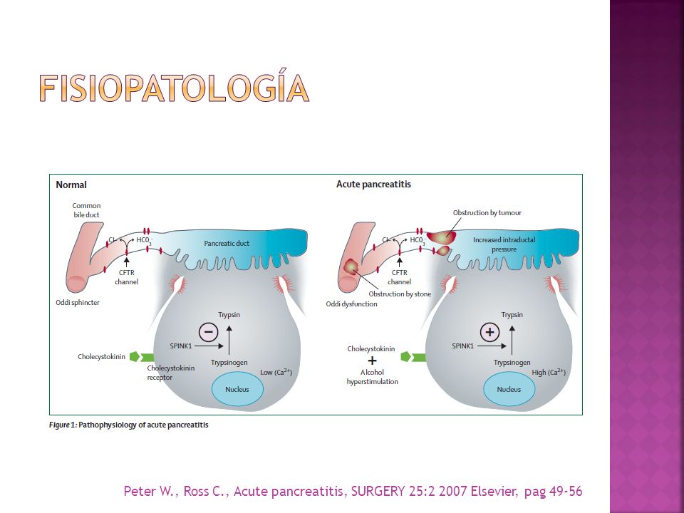 fISIOPATOLOGíA Peter W., Ross C., Acute pancreatitis, SURGERY 25: Elsevier, pag 49-56