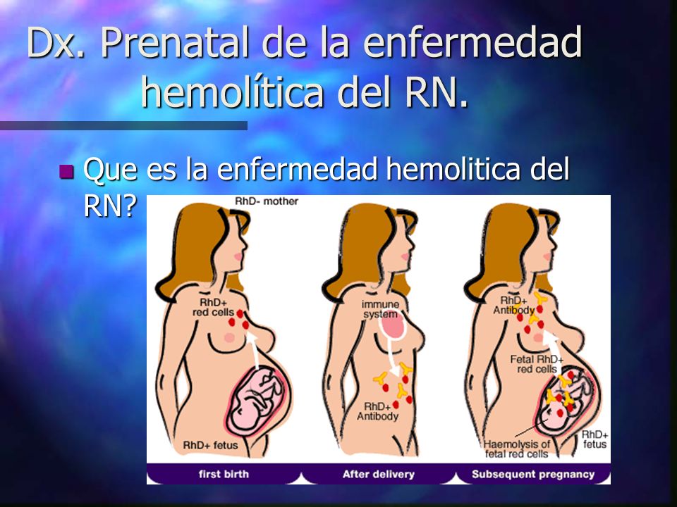 Dx. Prenatal de la enfermedad hemolítica del RN.