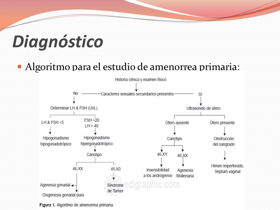 Diagnóstico Algoritmo para el estudio de amenorrea primaria: