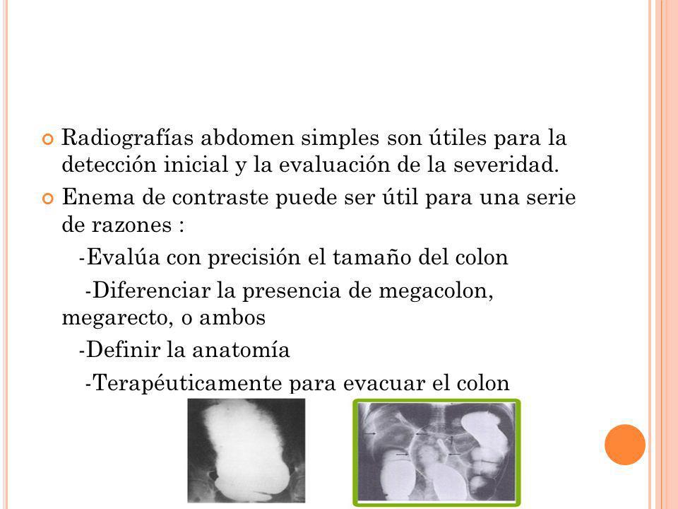 Radiografías abdomen simples son útiles para la detección inicial y la evaluación de la severidad.