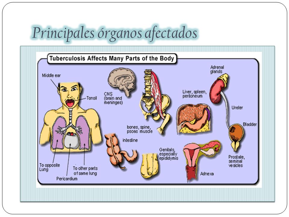 Principales órganos afectados