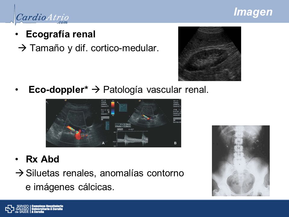 Imagen Ecografía renal  Tamaño y dif. cortico-medular.