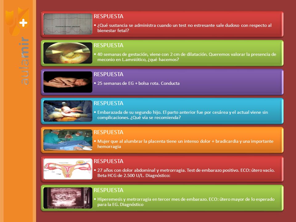 RESPUESTA ¿Qué sustancia se administra cuando un test no estresante sale dudoso con respecto al bienestar fetal