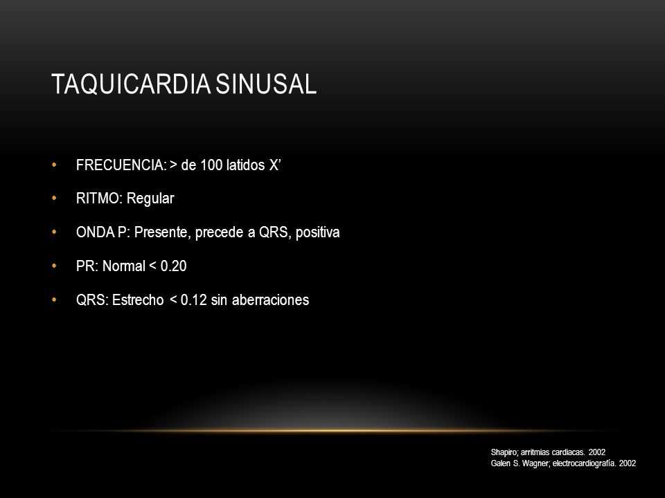 Taquicardia sinusal FRECUENCIA: > de 100 latidos X’ RITMO: Regular