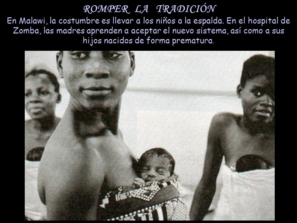 ROMPER LA TRADICIÓN En Malawi, la costumbre es llevar a los niños a la espalda.
