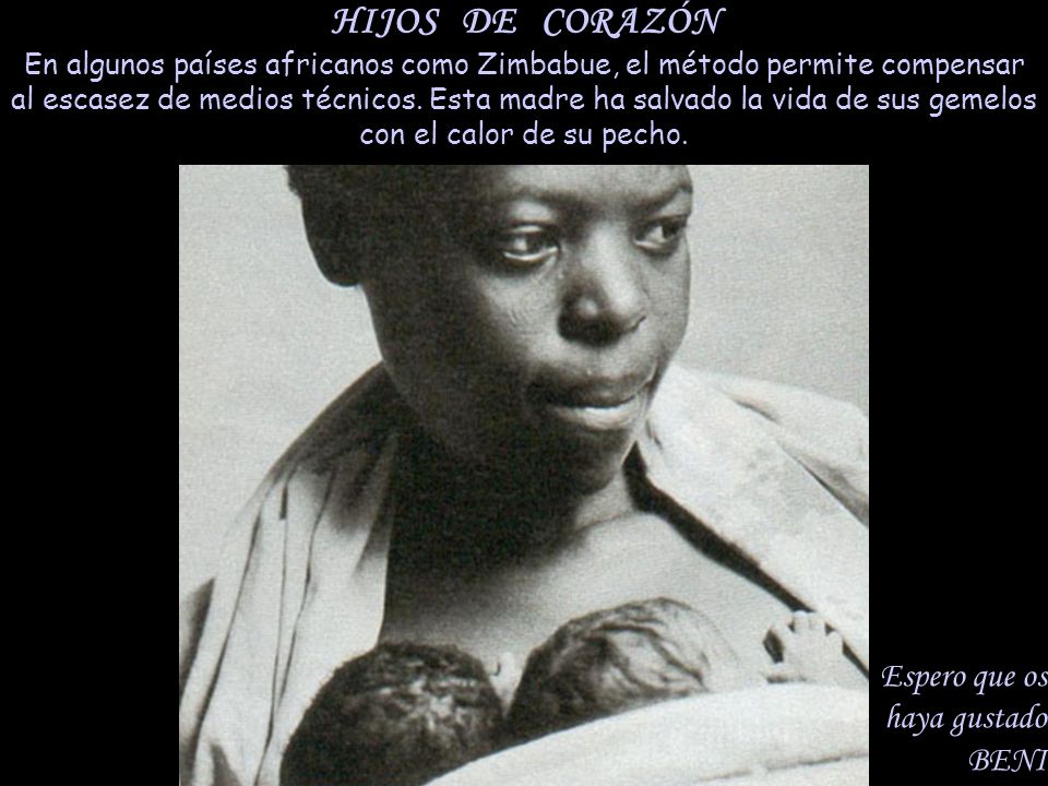HIJOS DE CORAZÓN En algunos países africanos como Zimbabue, el método permite compensar al escasez de medios técnicos. Esta madre ha salvado la vida de sus gemelos con el calor de su pecho.