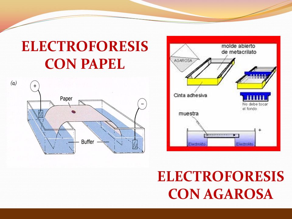 Tema 3 Técnicas en Bioquímica Electroforesis - ppt video online descargar
