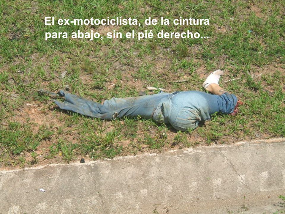 El ex-motociclista, de la cintura para abajo, sin el pié derecho...