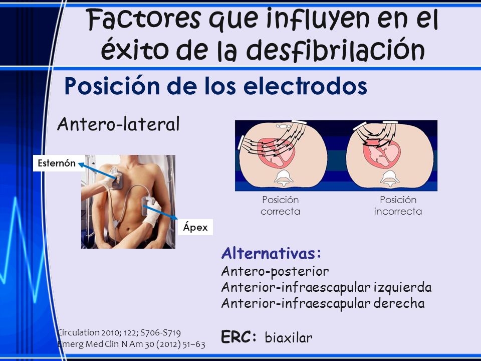 Factores que influyen en el éxito de la desfibrilación
