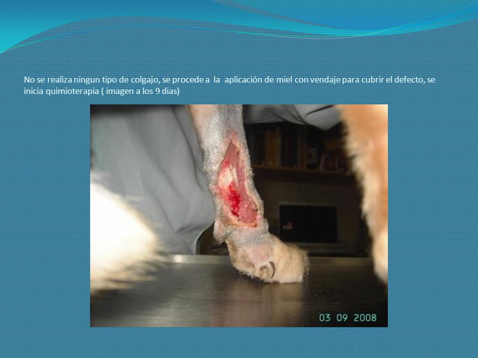 No se realiza ningun tipo de colgajo, se procede a la aplicación de miel con vendaje para cubrir el defecto, se inicia quimioterapia ( imagen a los 9 dias)