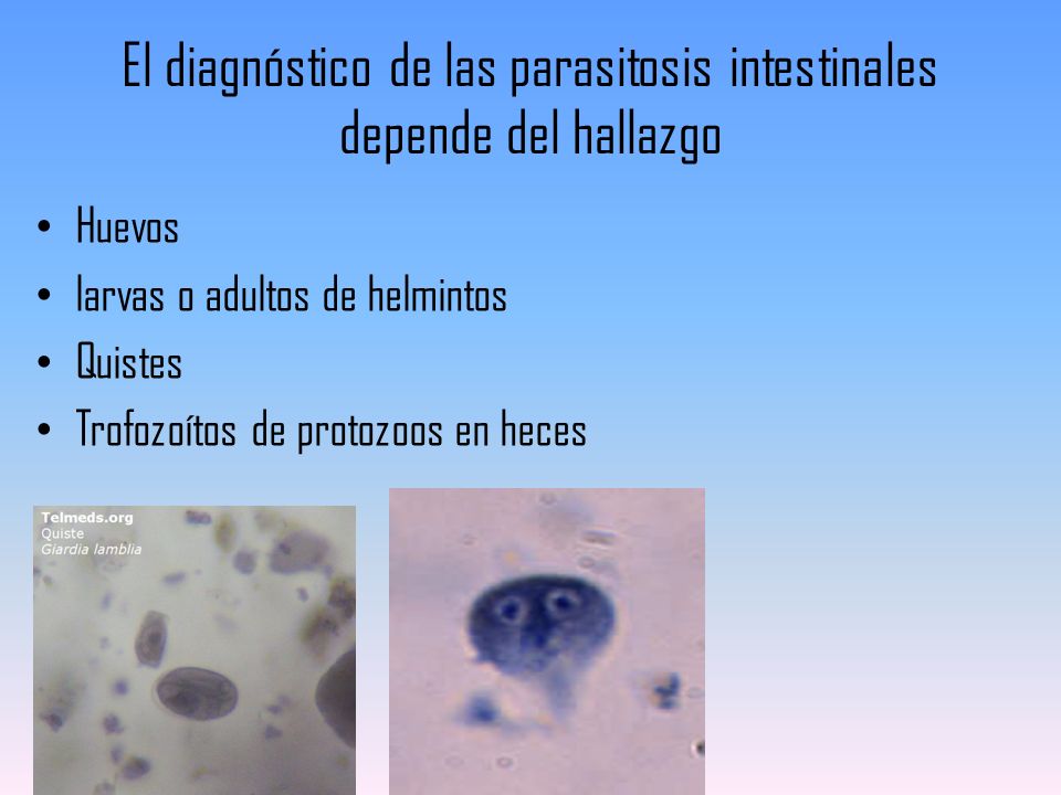 El diagnóstico de las parasitosis intestinales depende del hallazgo