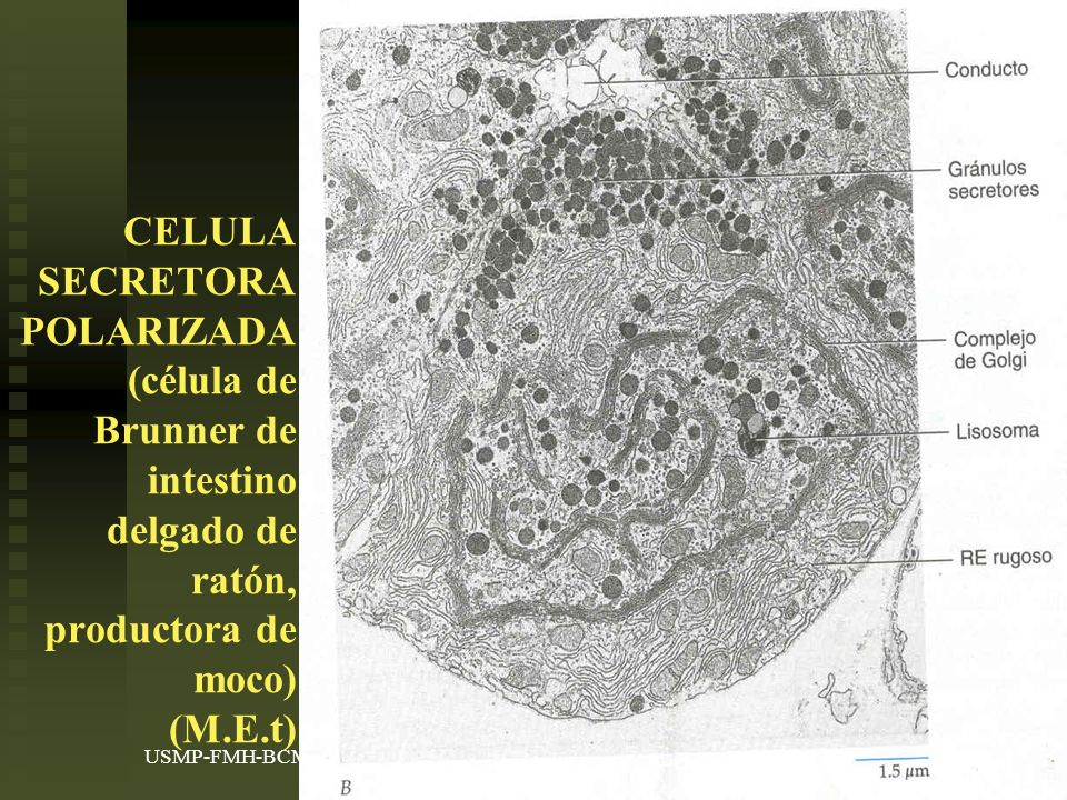 CELULA SECRETORA POLARIZADA (célula de Brunner de intestino delgado de ratón, productora de moco) (M.E.t)