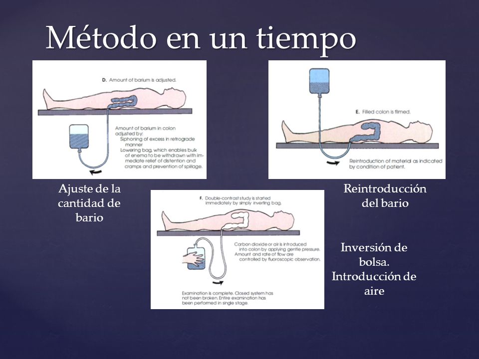 Método en un tiempo Ajuste de la cantidad de bario