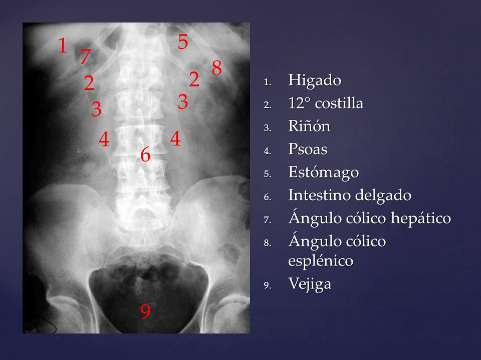 Radiologia: Abdômen simples