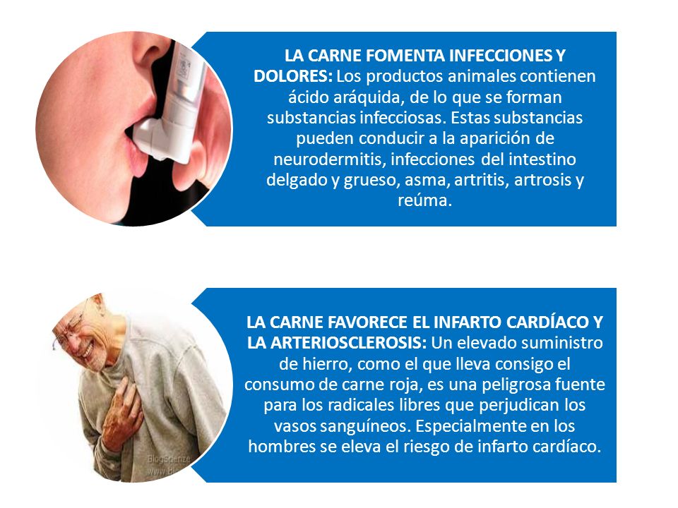 LA CARNE FOMENTA INFECCIONES Y DOLORES: Los productos animales contienen ácido aráquida, de lo que se forman substancias infecciosas. Estas substancias pueden conducir a la aparición de neurodermitis, infecciones del intestino delgado y grueso, asma, artritis, artrosis y reúma.