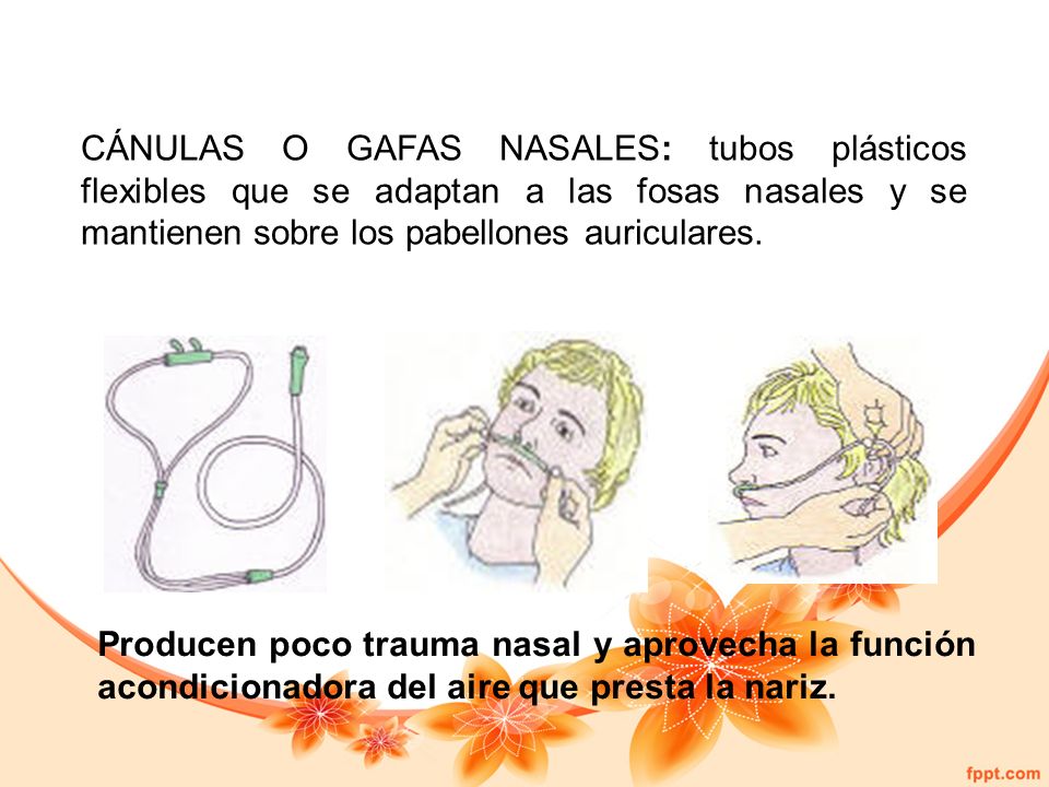 CÁNULAS O GAFAS NASALES: tubos plásticos flexibles que se adaptan a las fosas nasales y se mantienen sobre los pabellones auriculares.