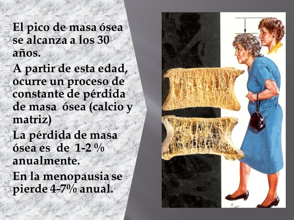 El pico de masa ósea se alcanza a los 30 años.