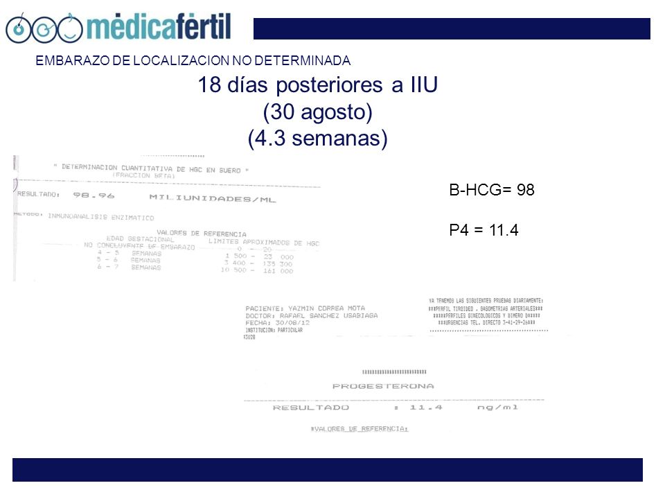 18 días posteriores a IIU (30 agosto) (4.3 semanas)