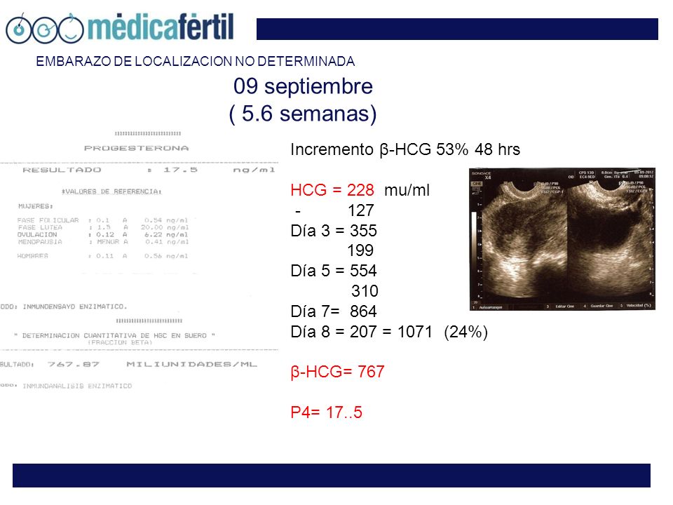 09 septiembre ( 5.6 semanas) Incremento β-HCG 53% 48 hrs
