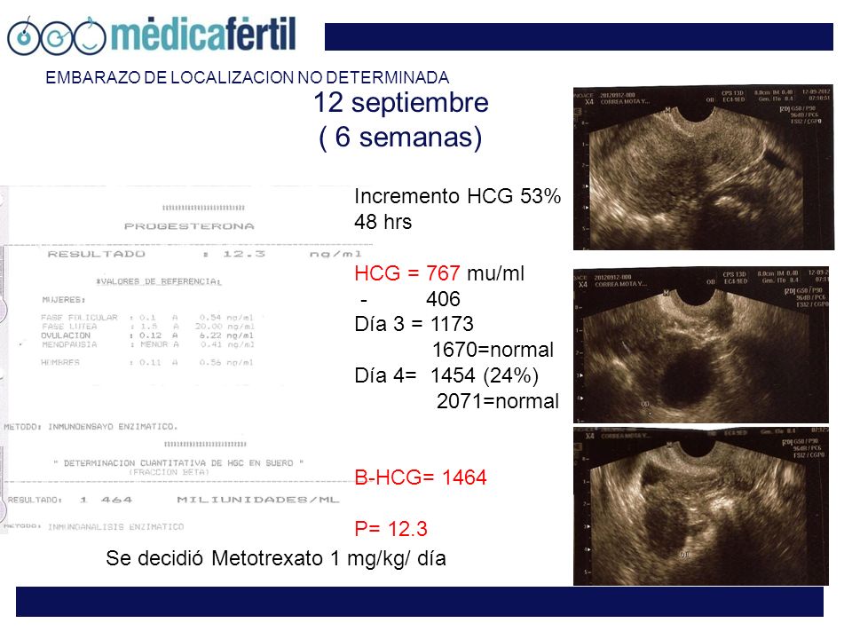 12 septiembre ( 6 semanas) Incremento HCG 53% 48 hrs HCG = 767 mu/ml