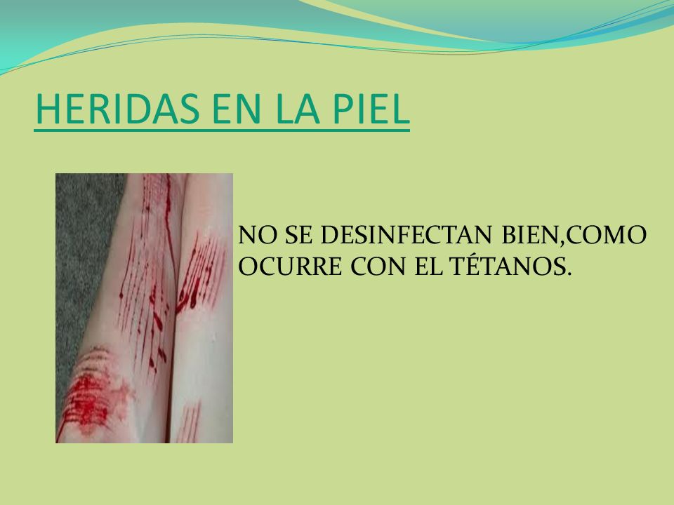 HERIDAS EN LA PIEL NO SE DESINFECTAN BIEN,COMO OCURRE CON EL TÉTANOS.