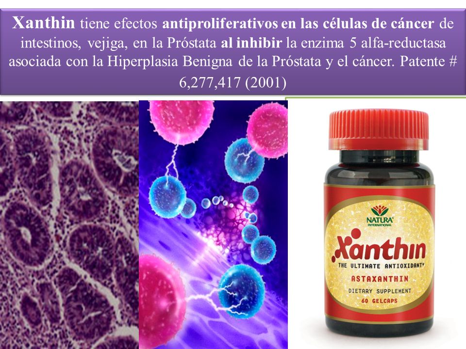 Xanthin tiene efectos antiproliferativos en las células de cáncer de intestinos, vejiga, en la Próstata al inhibir la enzima 5 alfa-reductasa asociada con la Hiperplasia Benigna de la Próstata y el cáncer.