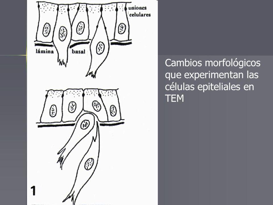 Cambios morfológicos que experimentan las células epiteliales en TEM