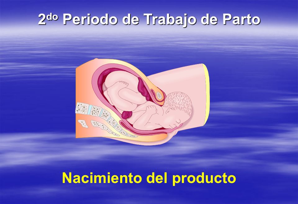 2do Periodo de Trabajo de Parto Nacimiento del producto