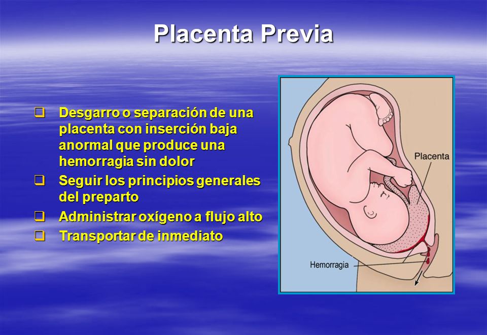 Placenta Previa Desgarro o separación de una placenta con inserción baja anormal que produce una hemorragia sin dolor.