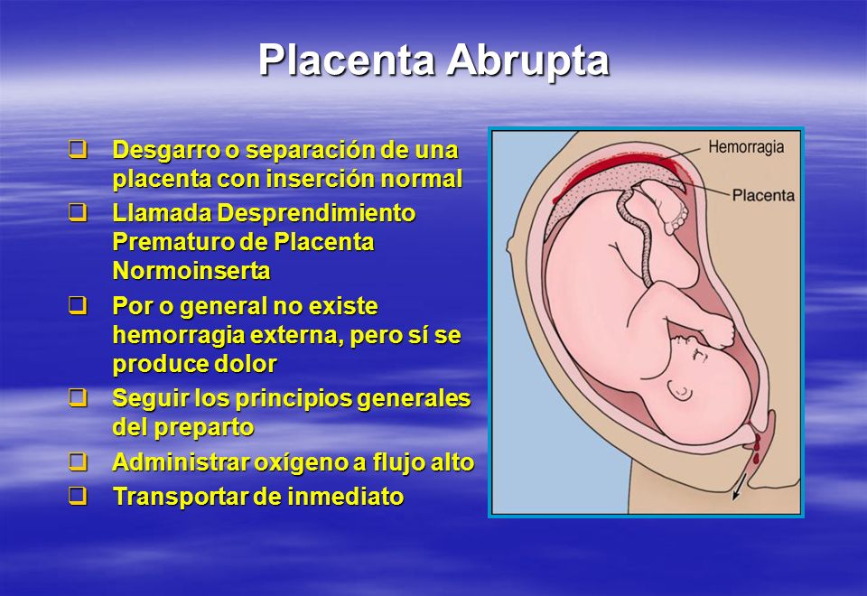 Placenta Abrupta Desgarro o separación de una placenta con inserción normal. Llamada Desprendimiento Prematuro de Placenta Normoinserta.