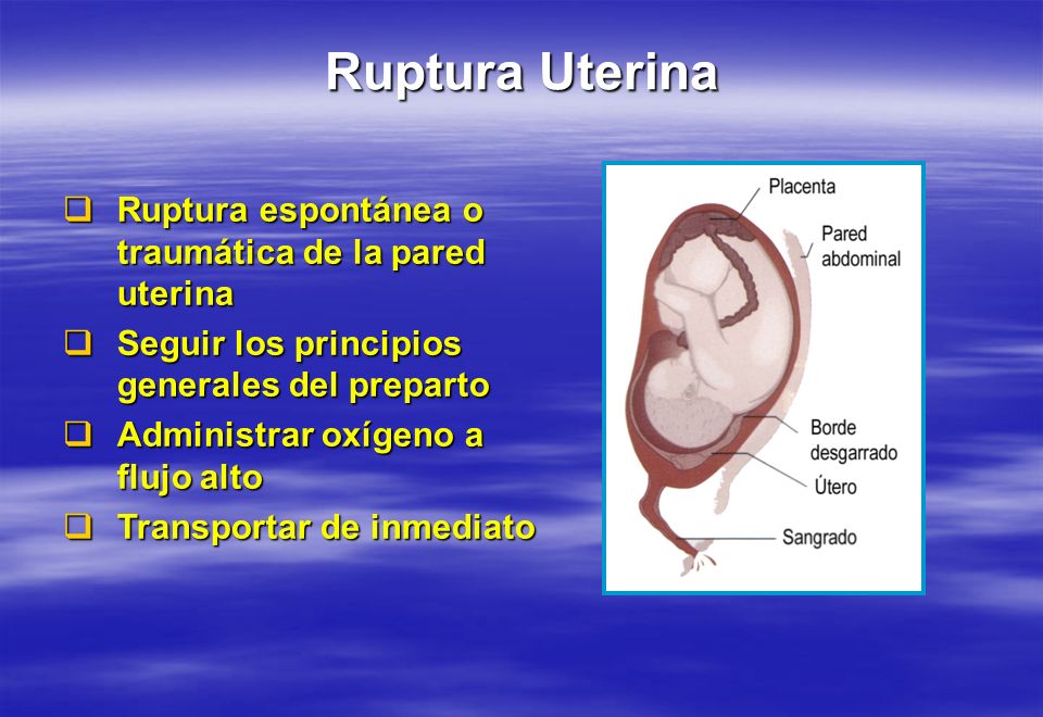 Ruptura Uterina Ruptura espontánea o traumática de la pared uterina