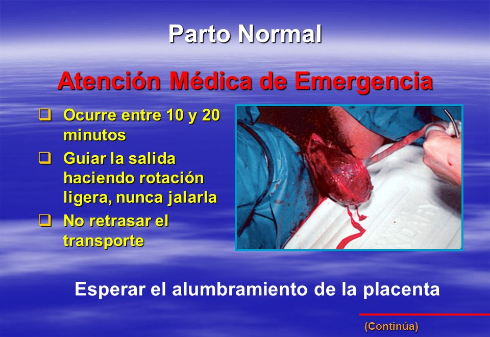 Atención Médica de Emergencia Esperar el alumbramiento de la placenta