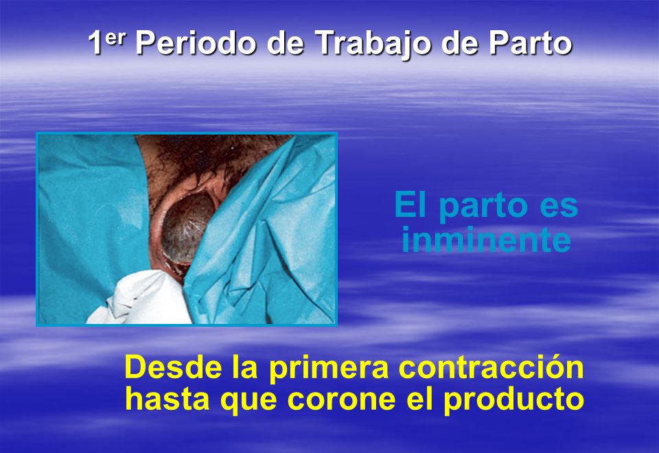 El parto es inminente 1er Periodo de Trabajo de Parto