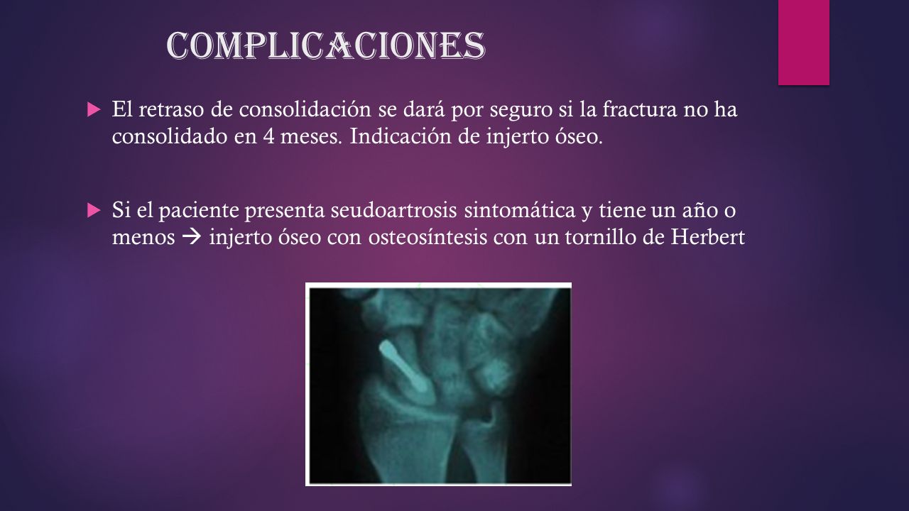 Complicaciones El retraso de consolidación se dará por seguro si la fractura no ha consolidado en 4 meses. Indicación de injerto óseo.