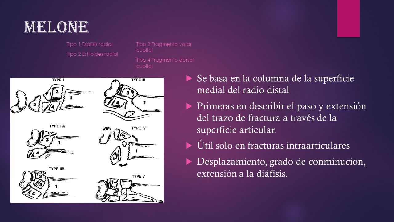 Melone Se basa en la columna de la superficie medial del radio distal