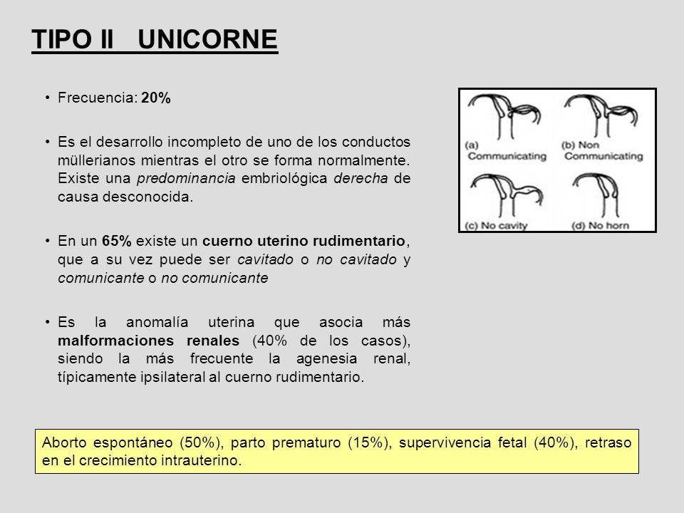 TIPO II UNICORNE Frecuencia: 20%