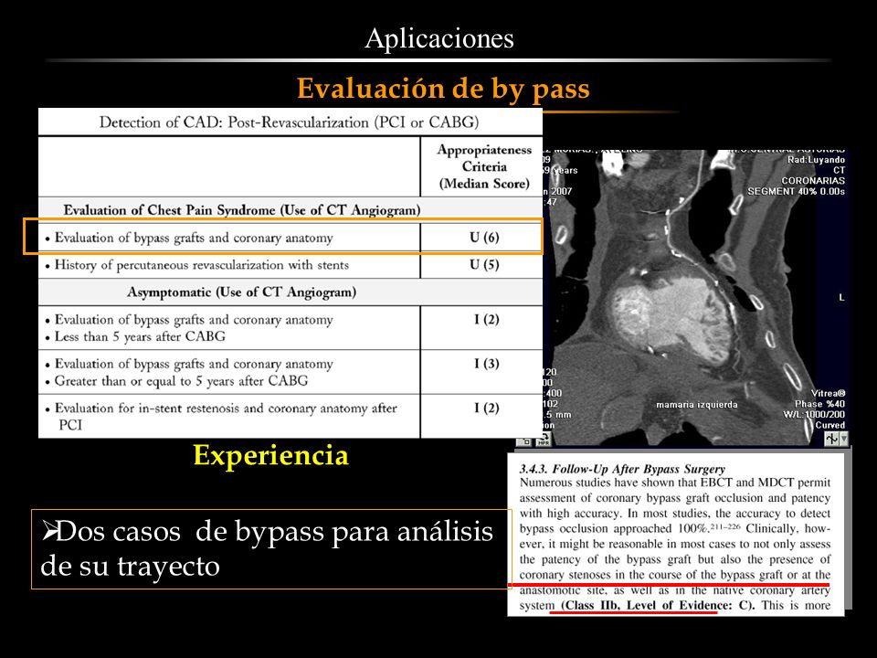 Aplicaciones Evaluación de by pass Experiencia Dos casos de bypass para análisis de su trayecto