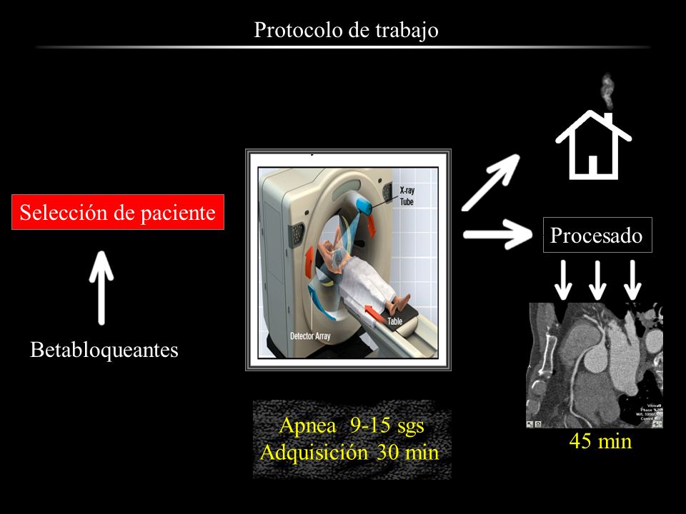 Protocolo de trabajo Selección de paciente. Procesado. Betabloqueantes. Apnea 9-15 sgs. Adquisición 30 min.